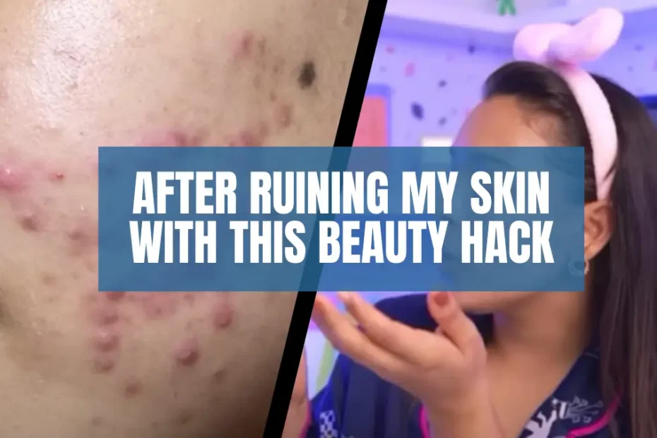 After Ruining My Skin With This Beauty Hack