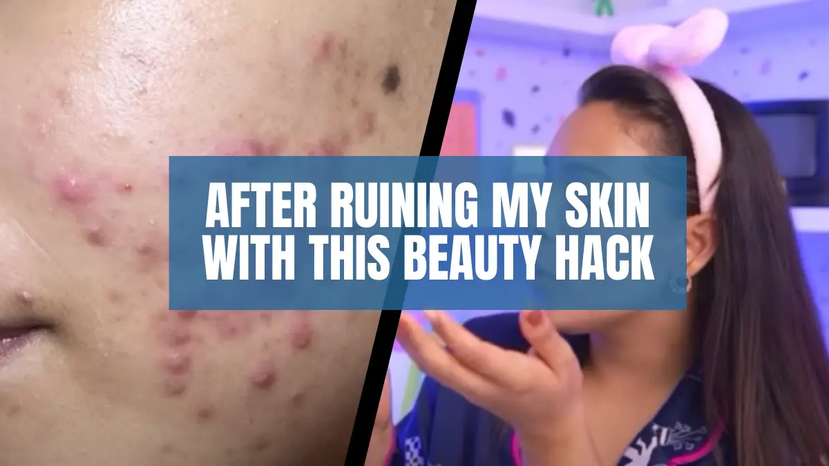 After Ruining My Skin With This Beauty Hack